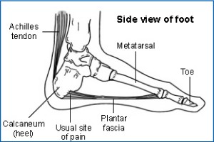 Foot Pain Image 2 website